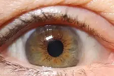 Irisdiagnose – Ausbildungsbeginn (20 Tage) mit Evelyn Würker